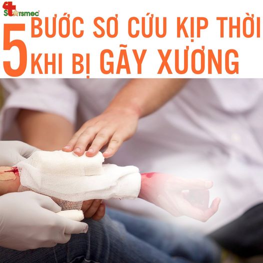 Lưu ý 5 bước sơ cứu kịp thời rất quan trọng khi bị gãy xương