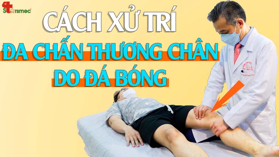 Đa chấn thương chân khi đá bóng - Xử trí như thế nào?