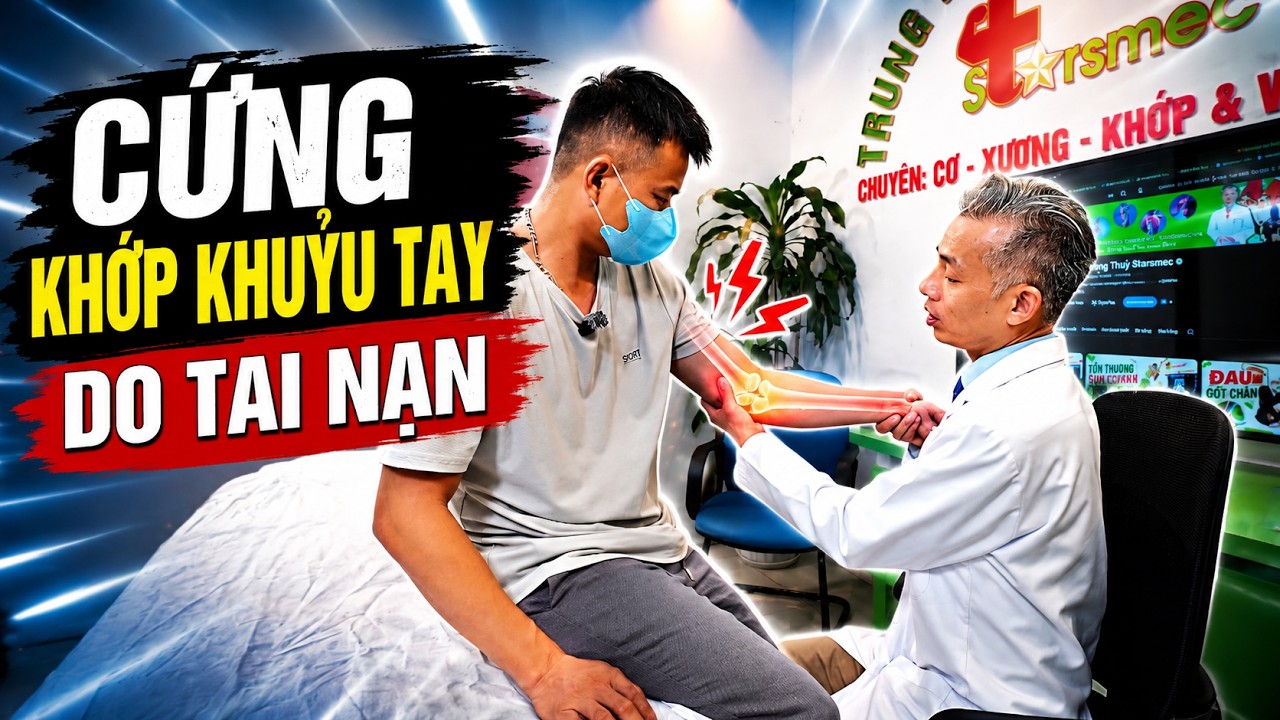 Cứng Khớp Khuỷu Tay: Nguyên Nhân, Triệu Chứng Và Cách Điều Trị Hiệu Quả