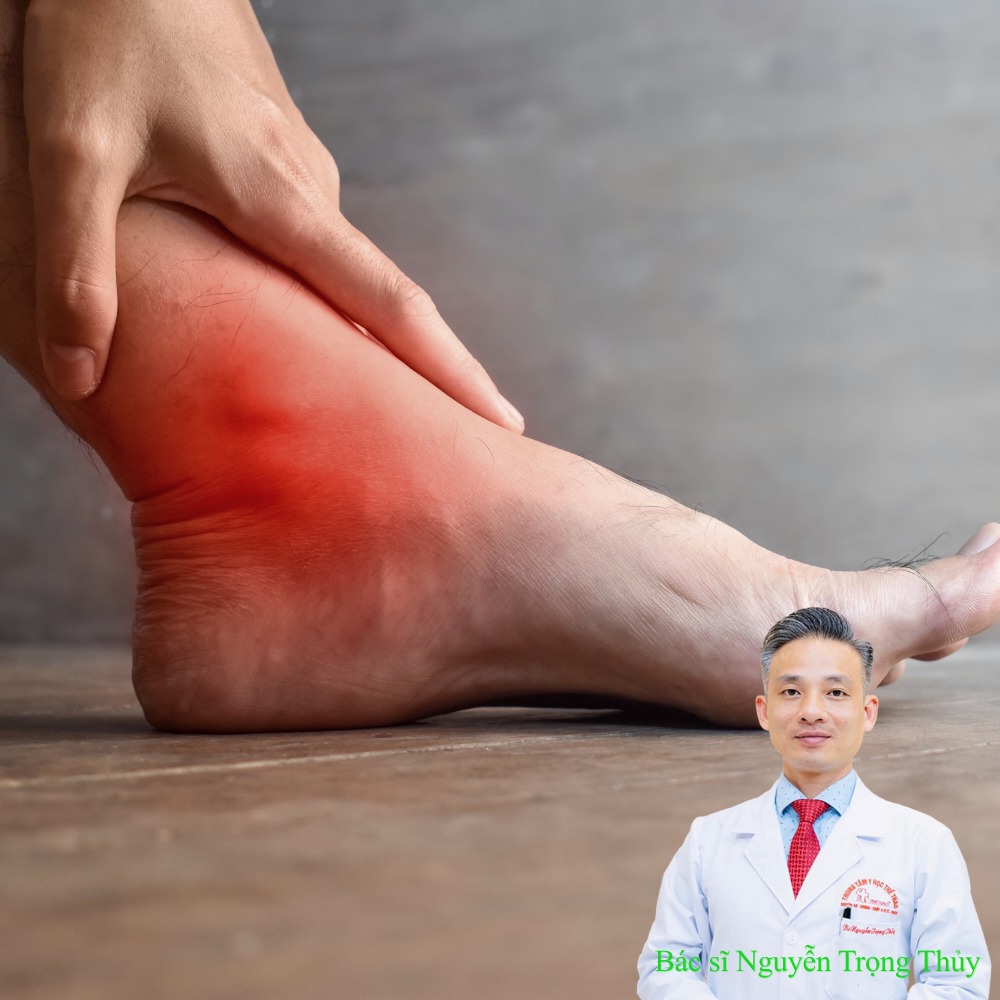 Chơi Pickleball Bị Đau Cổ Chân Có Thể Là Dấu Hiệu Của Bệnh Lý Gì?