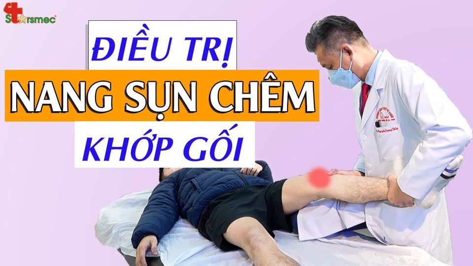 Điều trị nang sụn chêm khớp gối như thế nào?