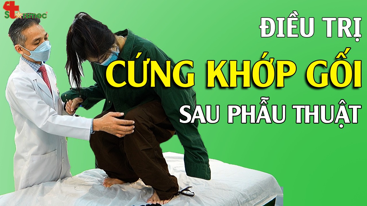 Điều trị phục hồi CỨNG KHỚP GỐI sau phẫu thuật hiệu quả