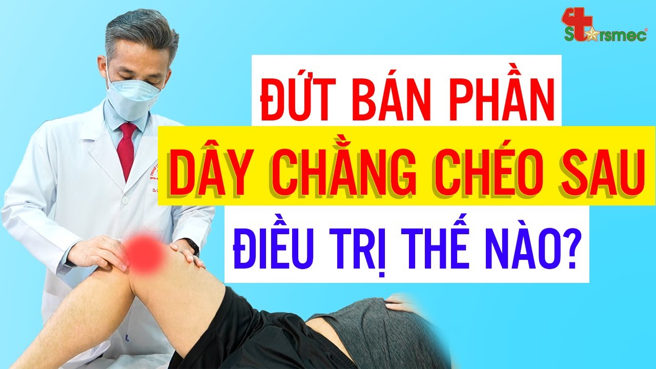 Đứt bán phần DÂY CHẰNG CHÉO SAU - Điều trị và chăm sóc thế nào?