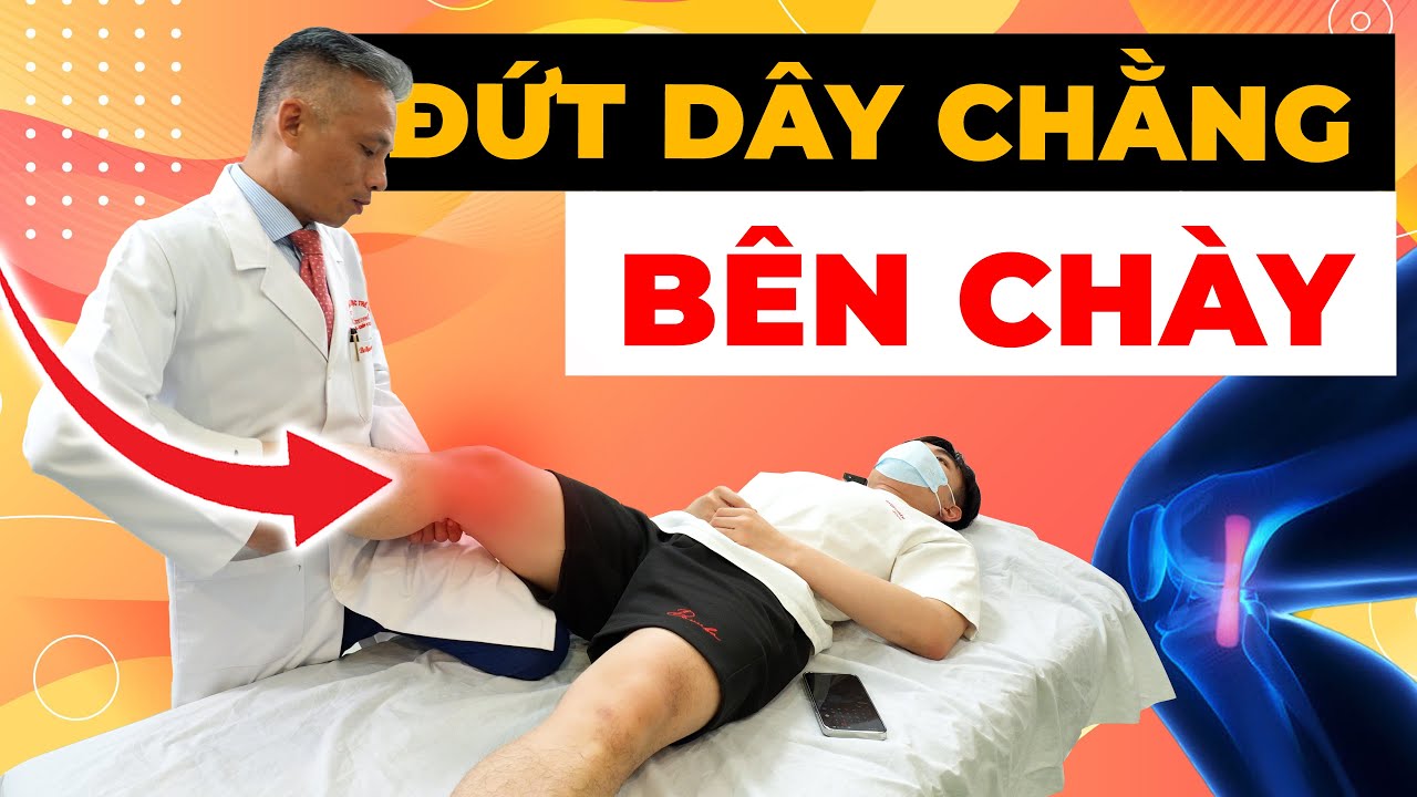 Đứt Dây Chằng Bên Chày (MCL): Nguyên Nhân, Triệu Chứng và Điều Trị