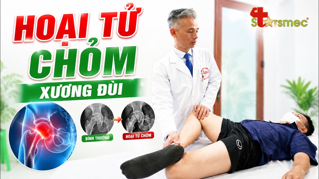Hoại tử chỏm xương đùi: Cơn đau âm thầm có thể khiến nhiều người mất khả năng đi lại