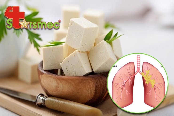 ĐẬU PHỤ có tốt cho người bị UNG THƯ PHỔI không? Có nên ăn không?