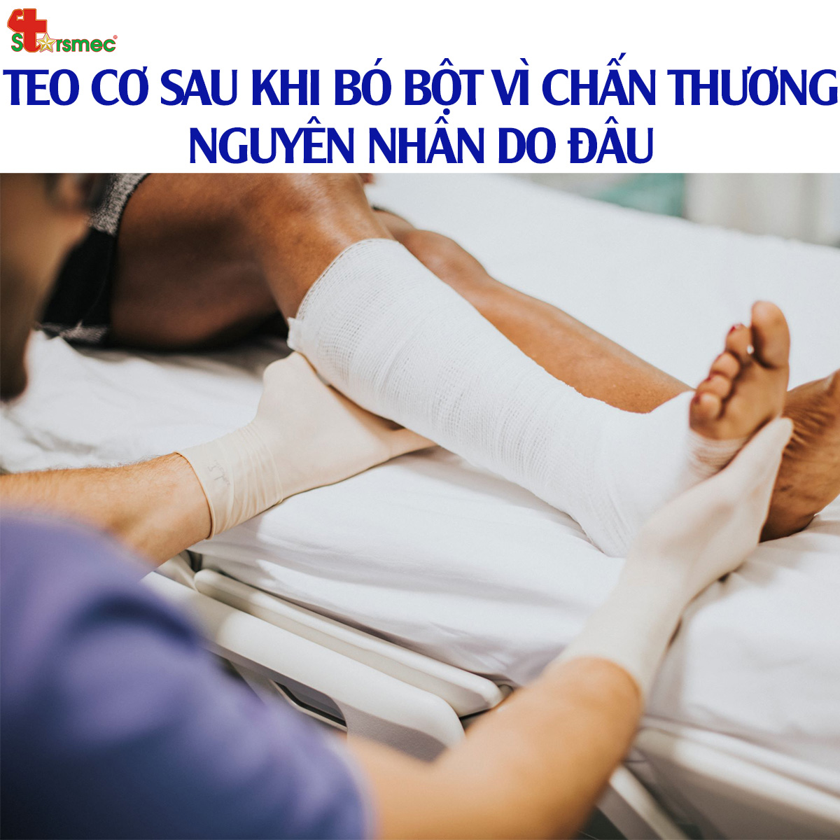 TEO CƠ sau khi BÓ BỘT vì chấn thương - Nguyên nhân do đâu?