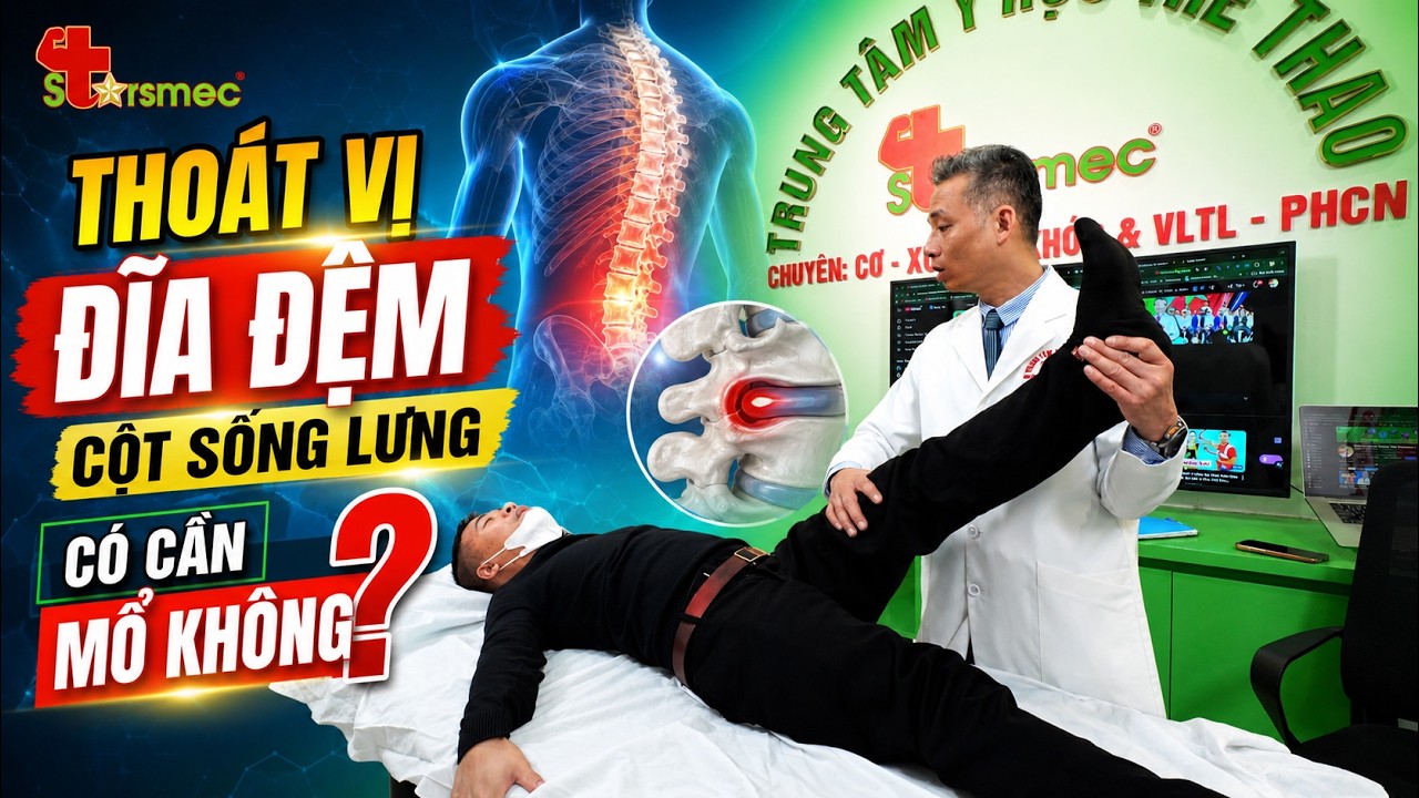 Thoát vị đĩa đệm có cần mổ không? Khi nào nên phẫu thuật và khi nào chưa cần?