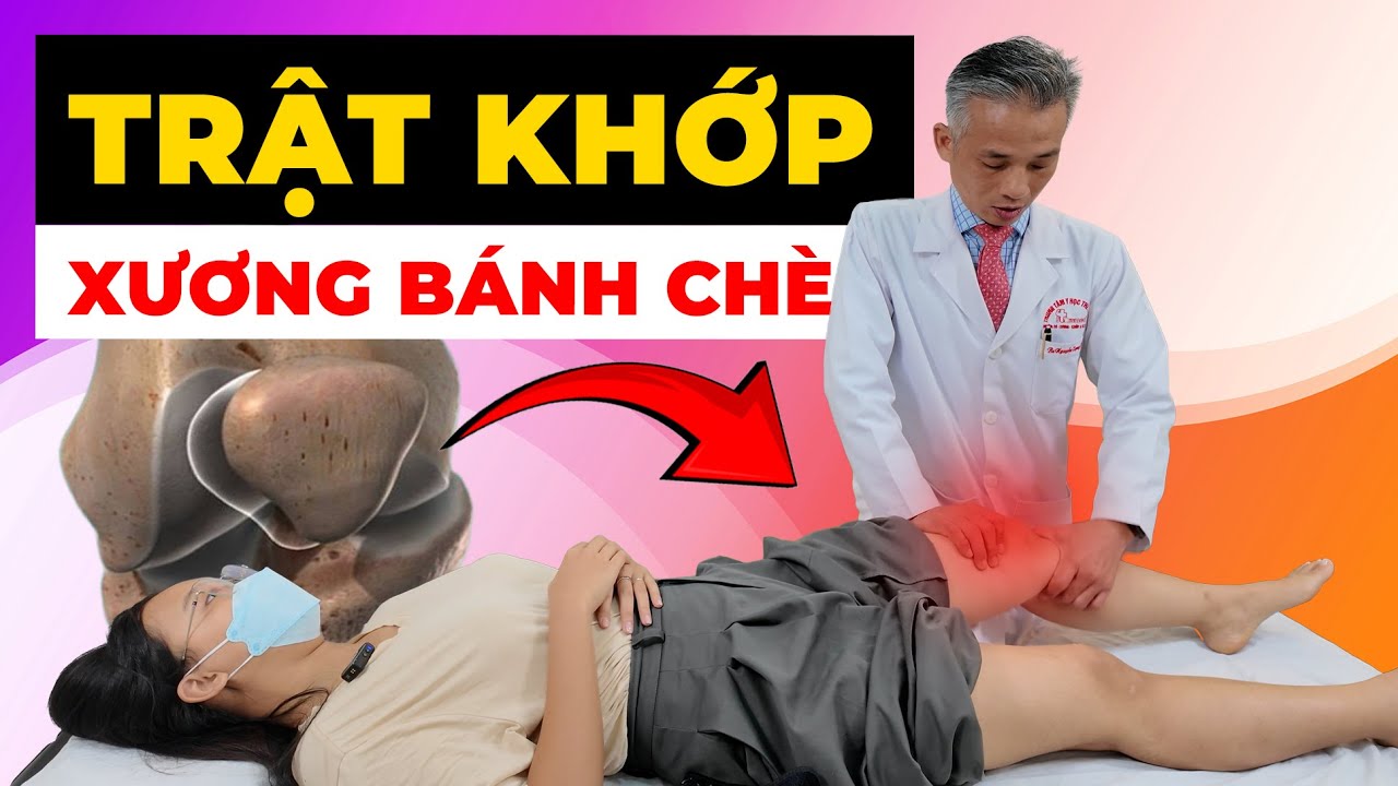Trật khớp xương bánh chè – Chăm sóc và điều trị như thế nào?