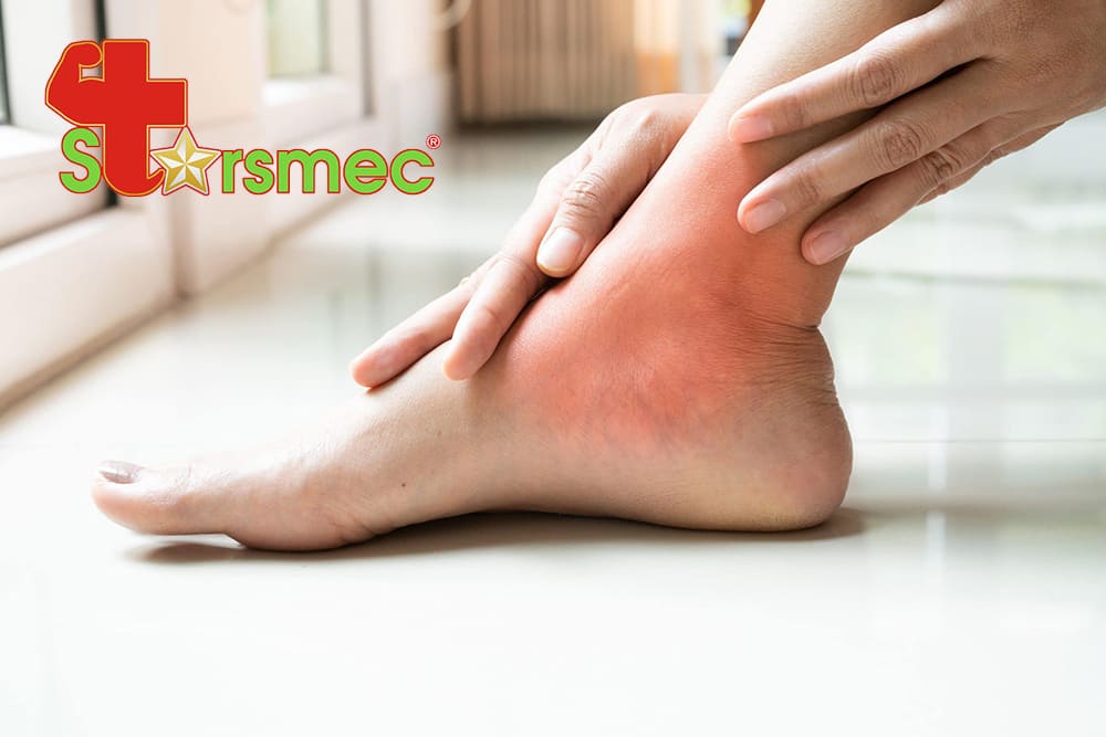 VIÊM BAO HOẠT DỊCH KHỚP CỔ CHÂN - Điều trị và chăm sóc như thế nào?