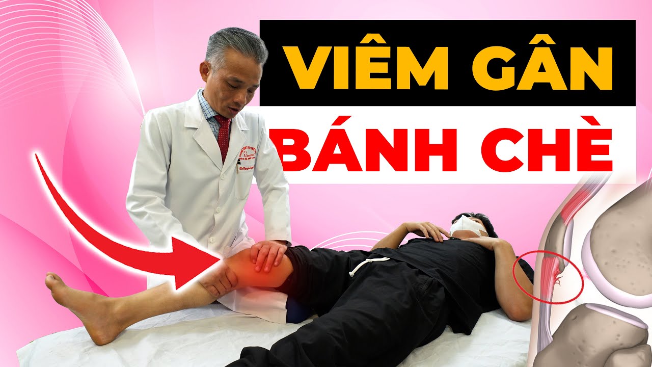 Viêm Gân Bánh Chè – Nguyên Nhân, Triệu Chứng và Cách Điều Trị Hiệu Quả
