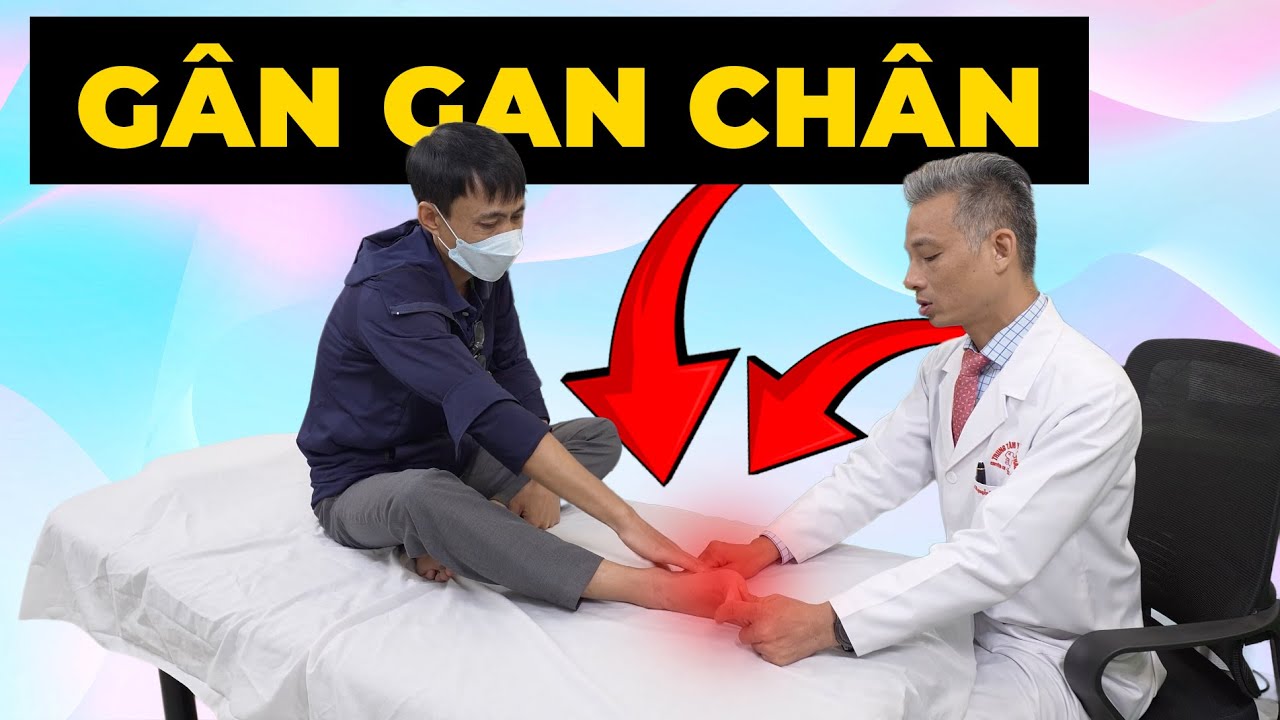 Viêm gân gan bàn chân: Nguyên nhân, triệu chứng và cách điều trị hiệu quả