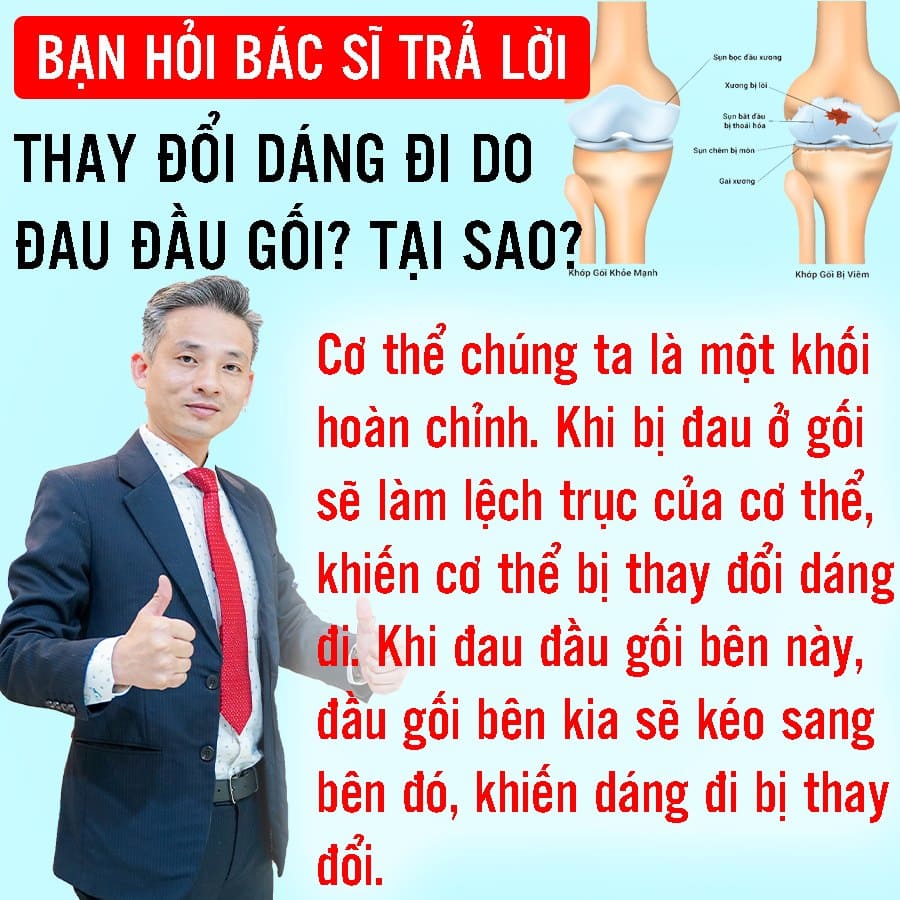 Bác sĩ thường xuyên có những chia sẻ về phòng chống chấn thương thể thao và cả cách luyện tập thể thao nâng cao sức khỏe, tăng đề kháng, cách phòng dịch Covid-19