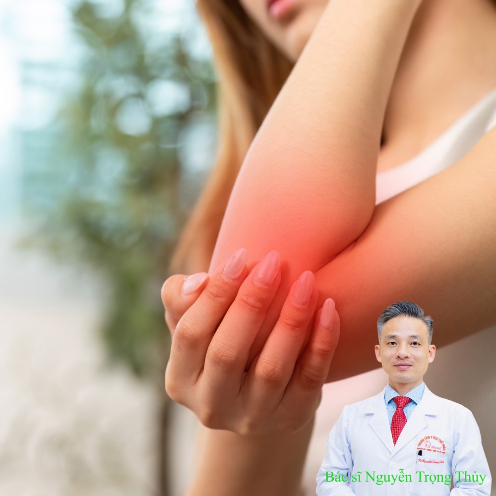 Đau cùi chỏ khi chơi Pickleball? Cách khắc phục an toàn & hiệu quả