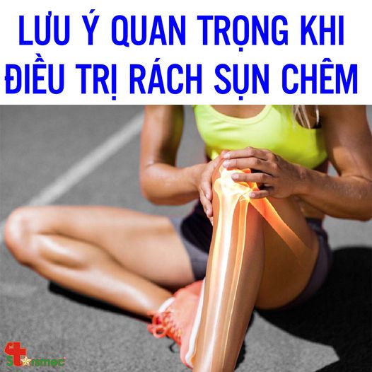 Một số LƯU Ý quan trọng khi điều trị RÁCH SỤN CHÊM