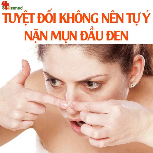 Người bệnh có nên tự ý NẶN MỤN ĐẦU ĐEN tại nhà không?