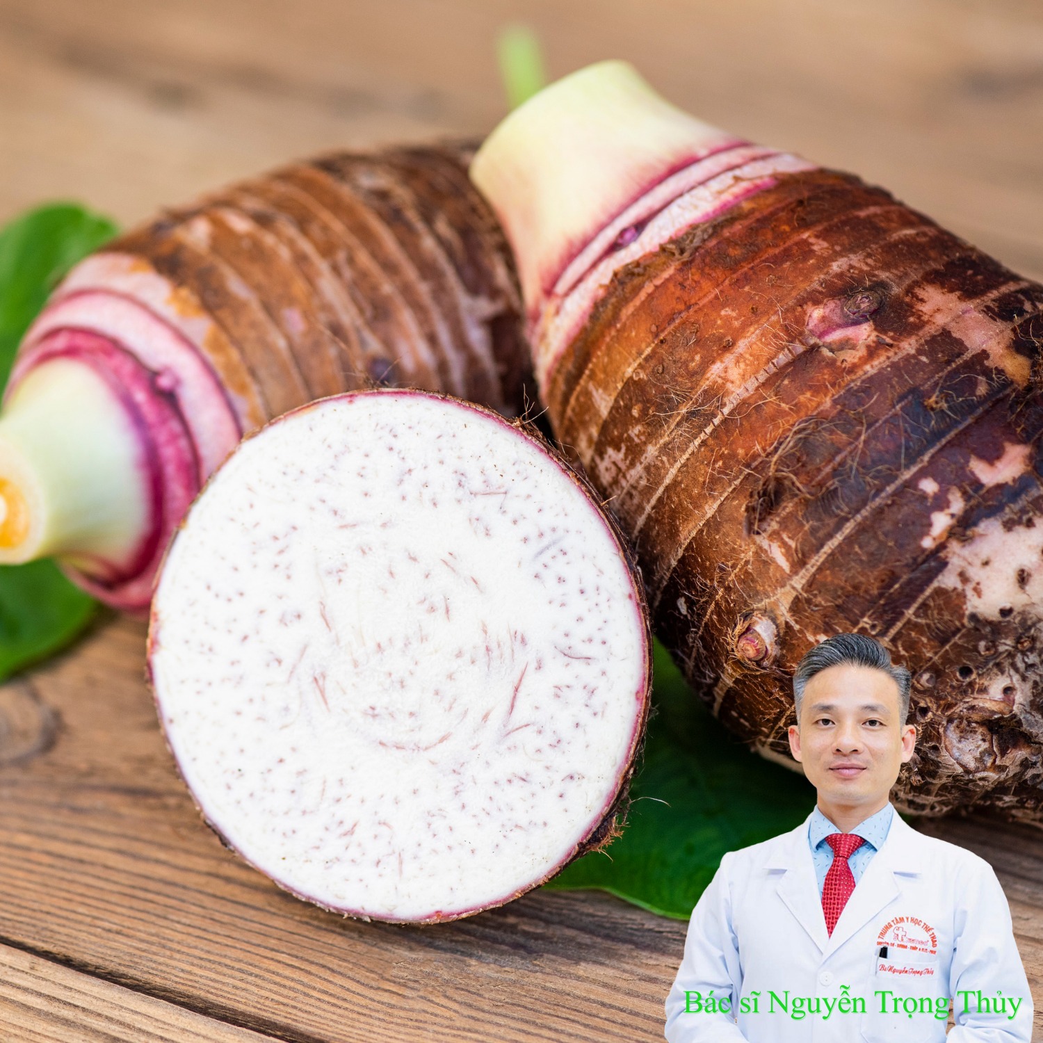 Những lợi ích bất ngờ của Khoai sọ đối với sức khỏe