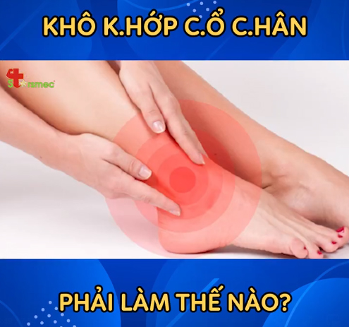 Khô khớp cổ chân - Điều trị và chăm sóc thế nào?