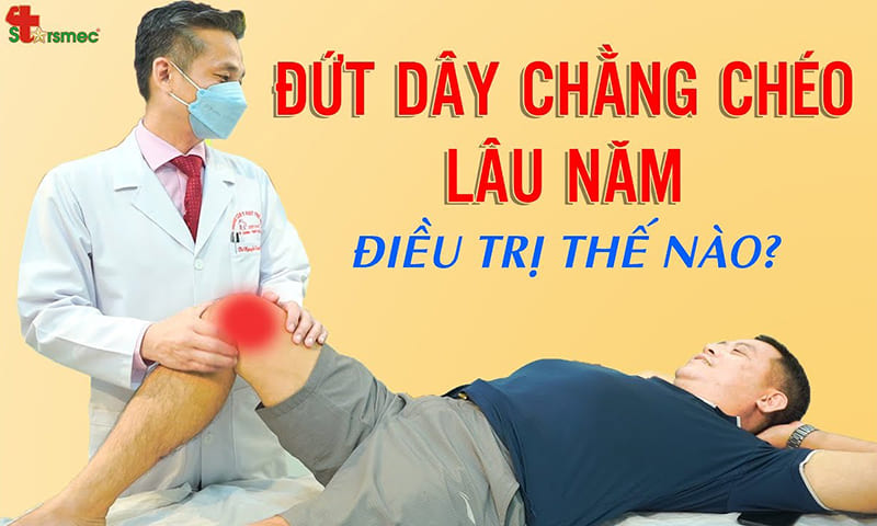 Đứt dây chằng chéo 15 năm Điều trị và chăm sóc thế nào