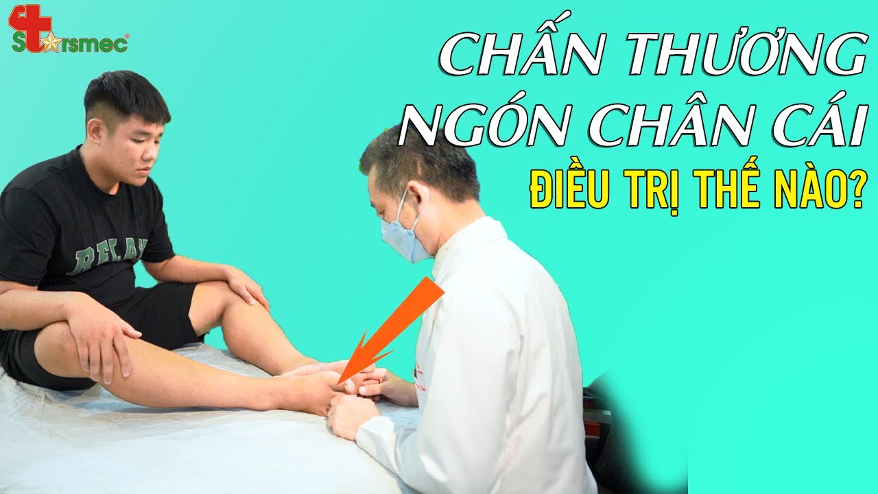 Khi nào cần đến bác sĩ nếu bị dập móng chân và cảm thấy nhức?
